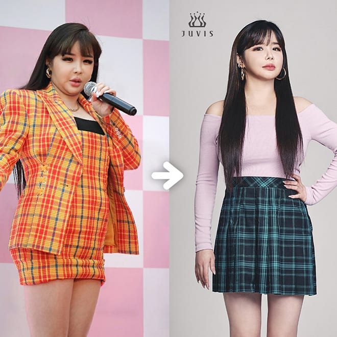 Losing 11 kg, Park Bom returns with a slim body and attractive visual
