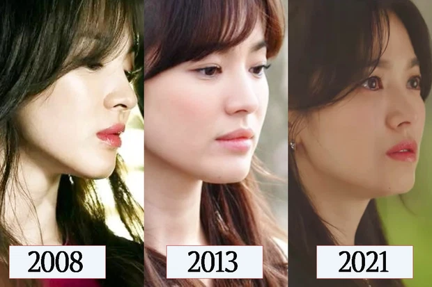 Song Hye-kyo seems to remain the same as time went by. Her perfectly structured nose, melancholy eyes, and her innocent beauty accent her side profile even more. Time seems to have forgotten her.