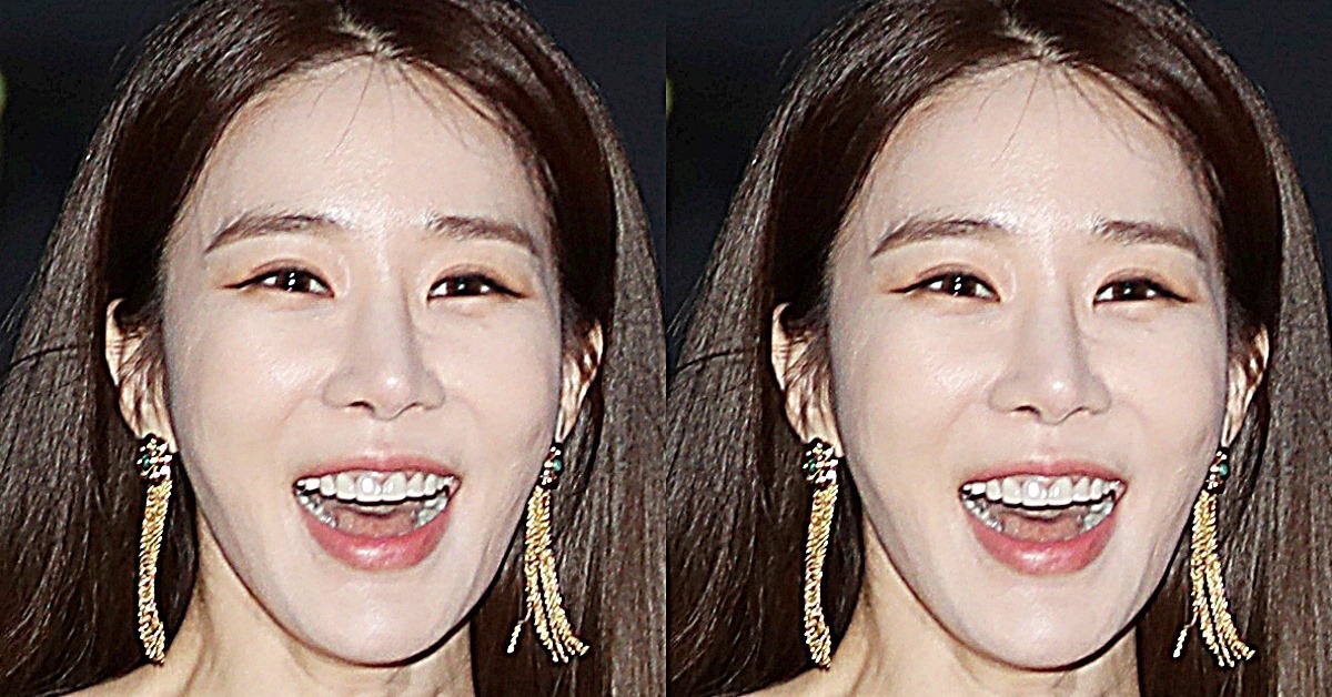 Yoo In-na