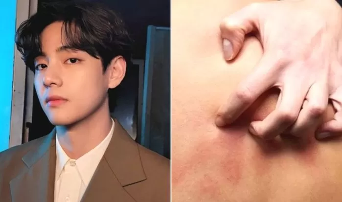 BTS V