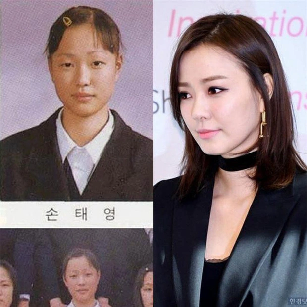 Son Tae Young