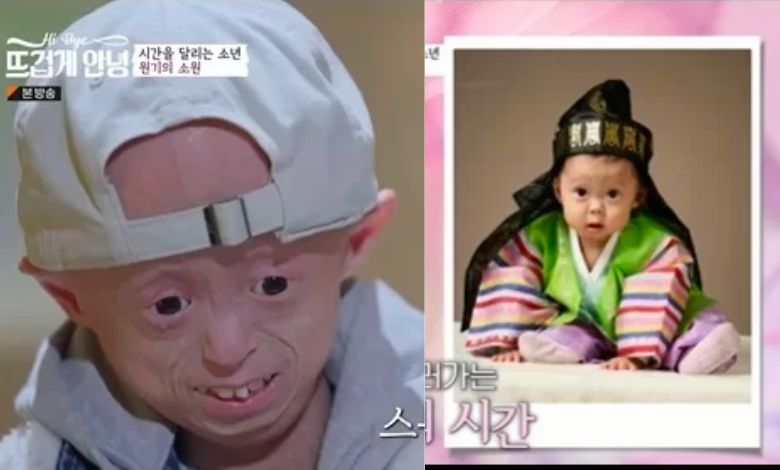 hong won ki thumbnail