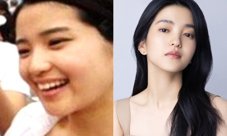 Kim Tae Ri thumbnail