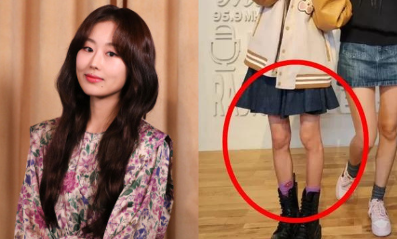 Lee Su Jeong thumbnail