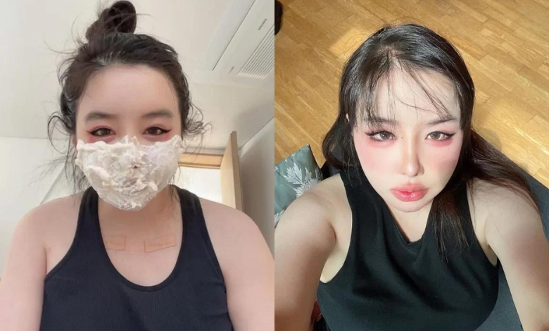 Park Bom thumbnail