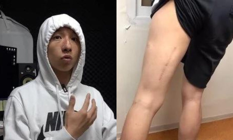Big Baby thumbnail
