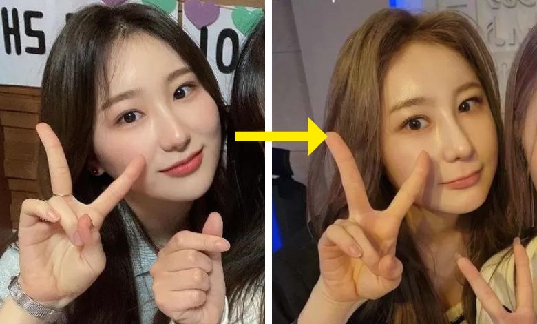 lee chaeyeon