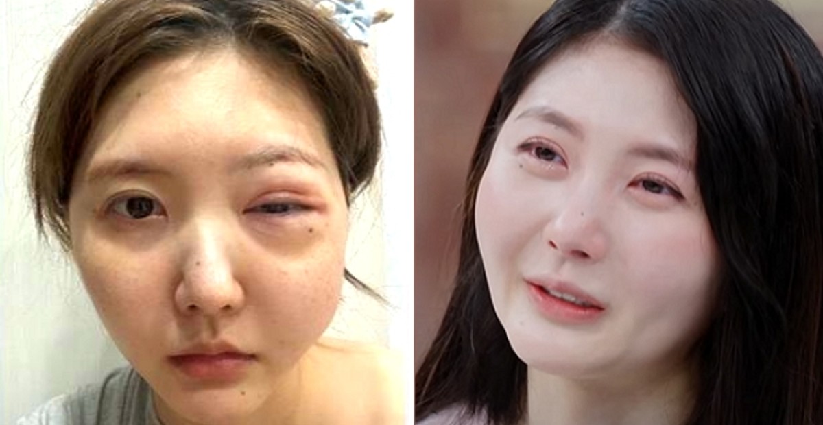 beauty thumbnail