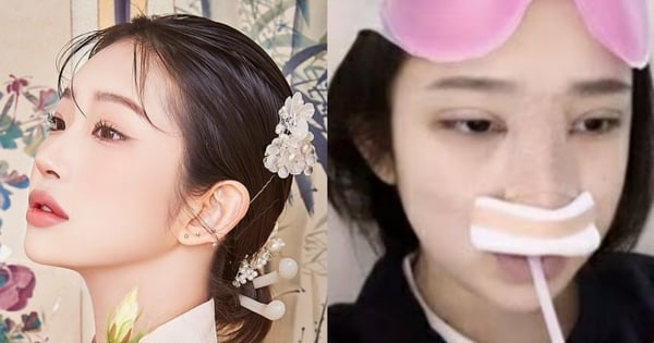 choi jin sik thumbnail