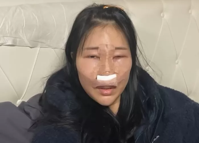 Lee Se-young