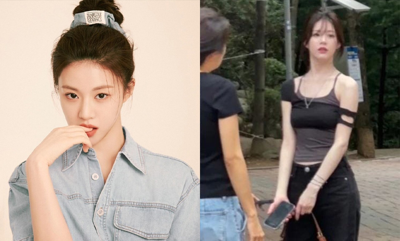 Go Yoon Jung’s outstanding visual in real-life photos
