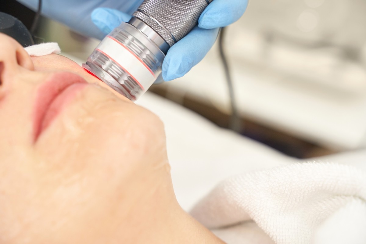 a actress Suffers Second-Degree Burn During Dermatology Procedure 
