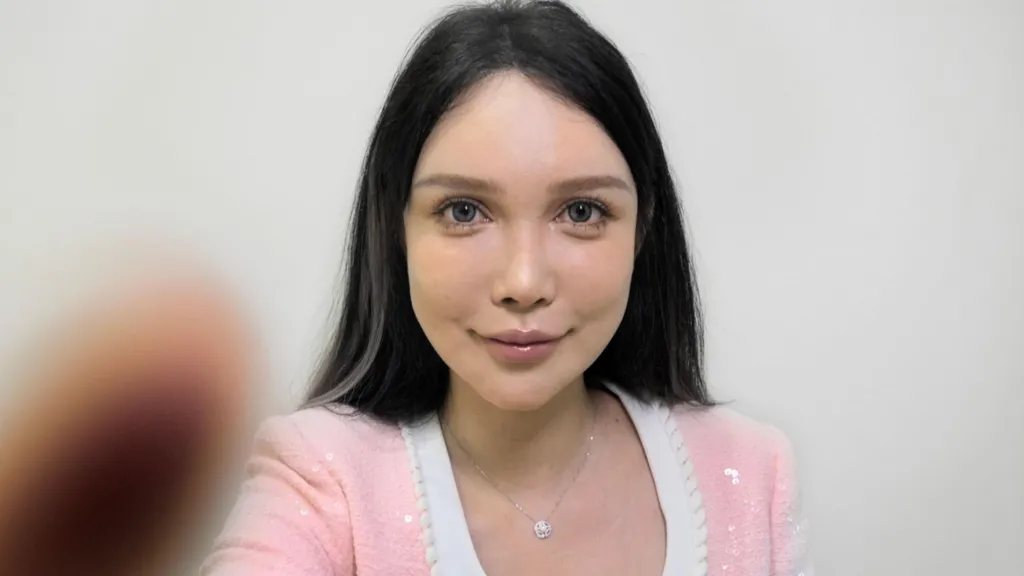 gao-liu-cosmetic-surgery-accident-abby-wu