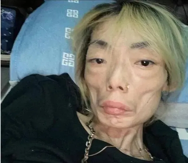 connie ng weight losswoman-thin-face-bed.