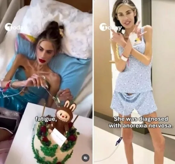 Turkish Influencer Nihal Candan Dead at 30 After Losing 40kg 1