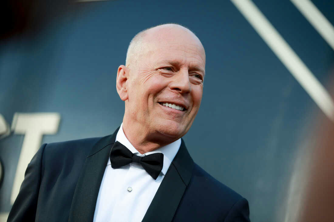 Bruce Willis in Final Stage of Dementia: Unable to Walk or Speak, Ex