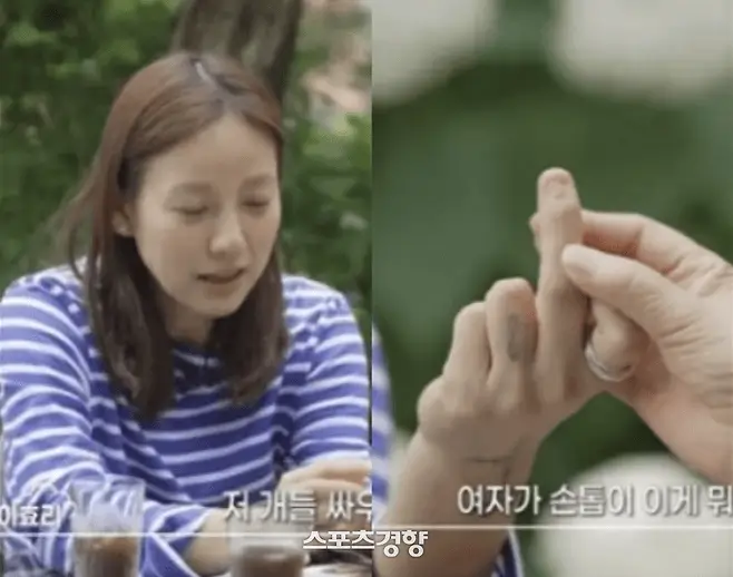 lee hyori dog bite surgery