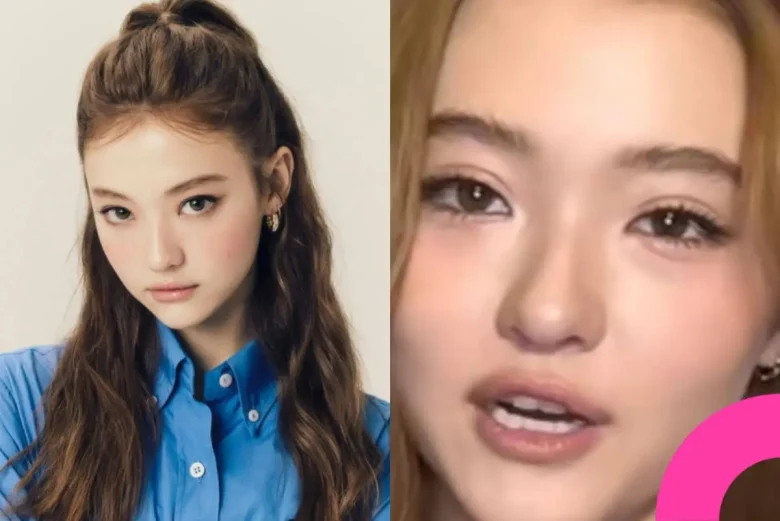 meovv ella double eyelid surgery