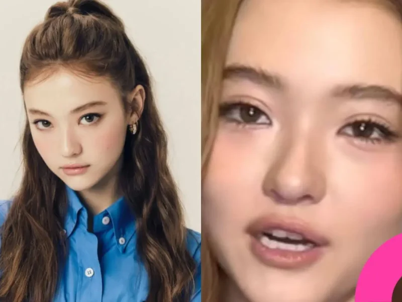 meovv ella double eyelid surgery