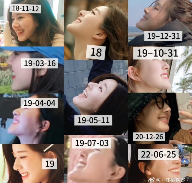 Zhao Lusi nose job rumorscollage' 'profiles' 'dates' 'smiling.