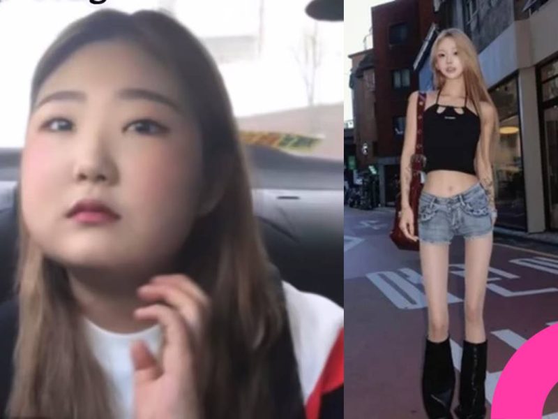 Choi Jun-hee plastic surgery and weight loss