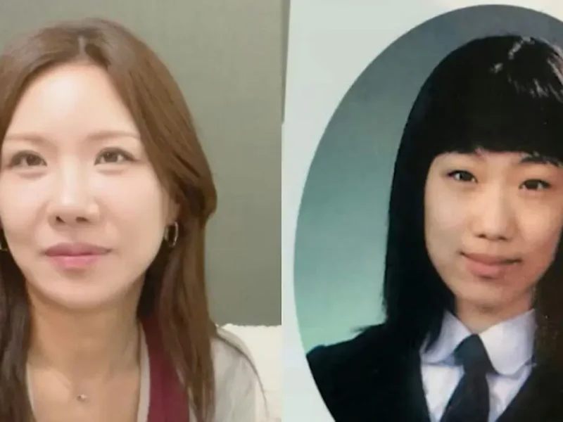 yeon yerim plastic surgery
