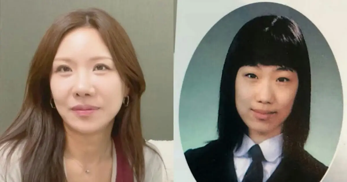 yeon yerim plastic surgery