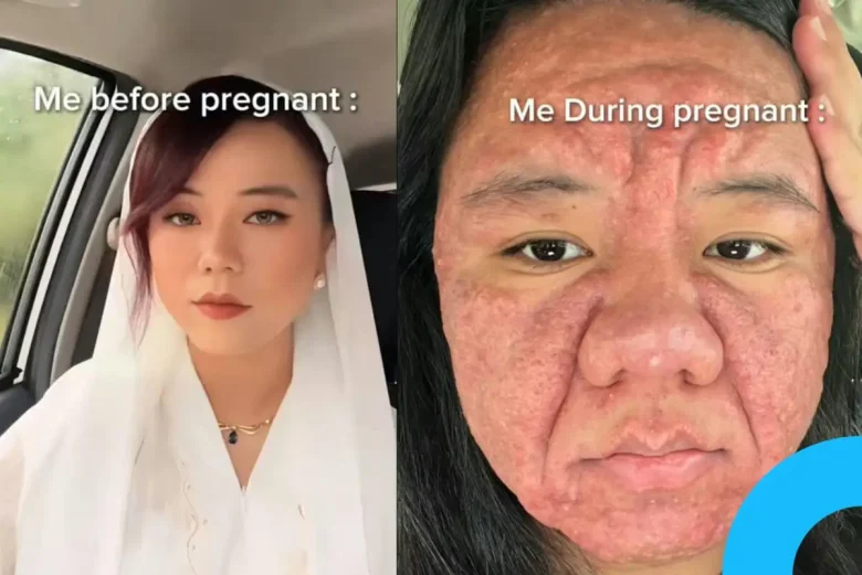 pregnancy transformation farah faizal