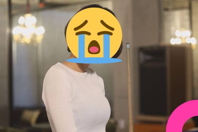 Lee Se-young plastic surgery