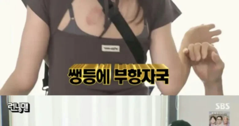 song jihyo cupping marks running man