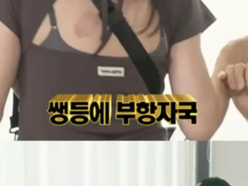 song jihyo cupping marks running man