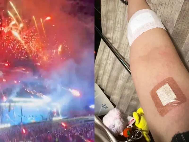 seventeen concert firework accident