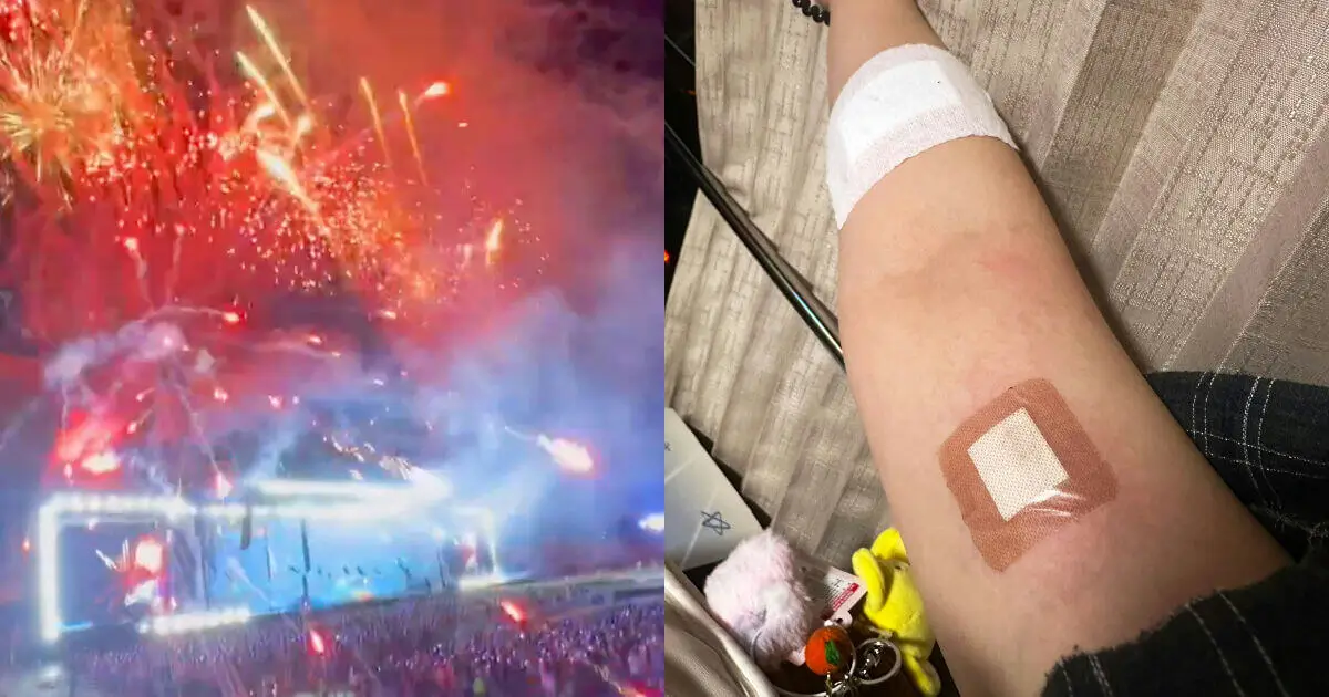 seventeen concert firework accident
