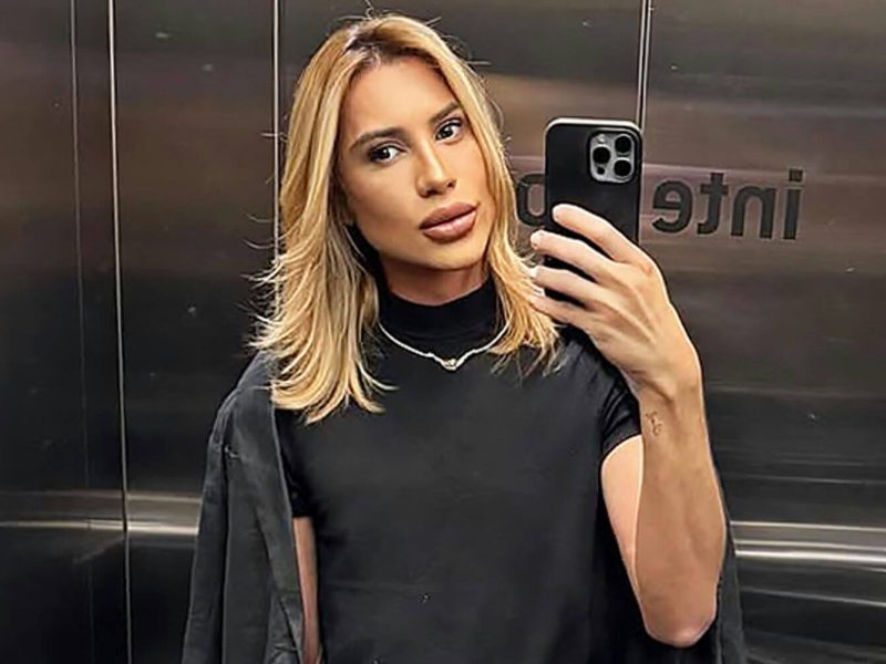 fox eyes cosmetic surgery death