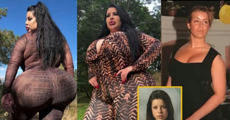 natasha crown worlds biggest butt surgery