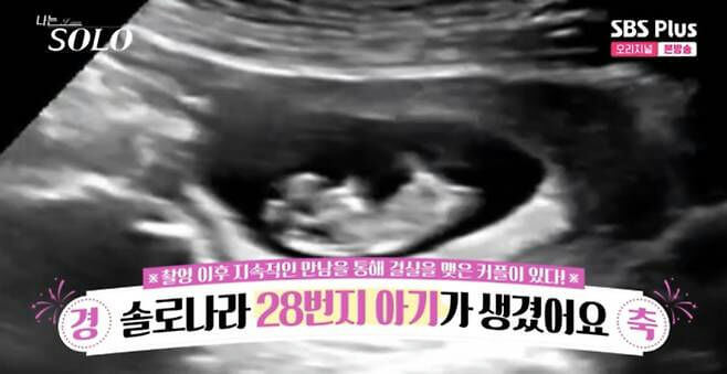 ultrasound-A-fetus-A-Korean-text-A-TV-program-logo