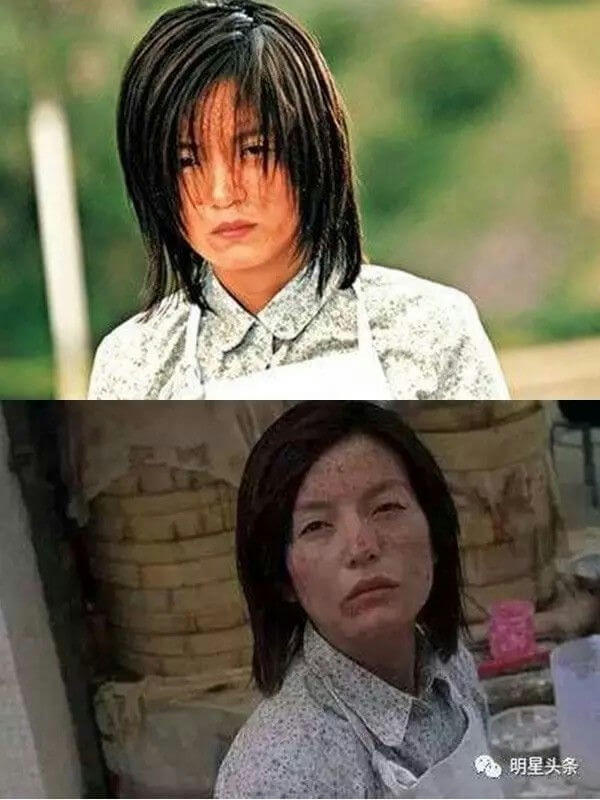 people-woman-A-before and after comparison-B-dark shoulder-length hair-C-skin condition change