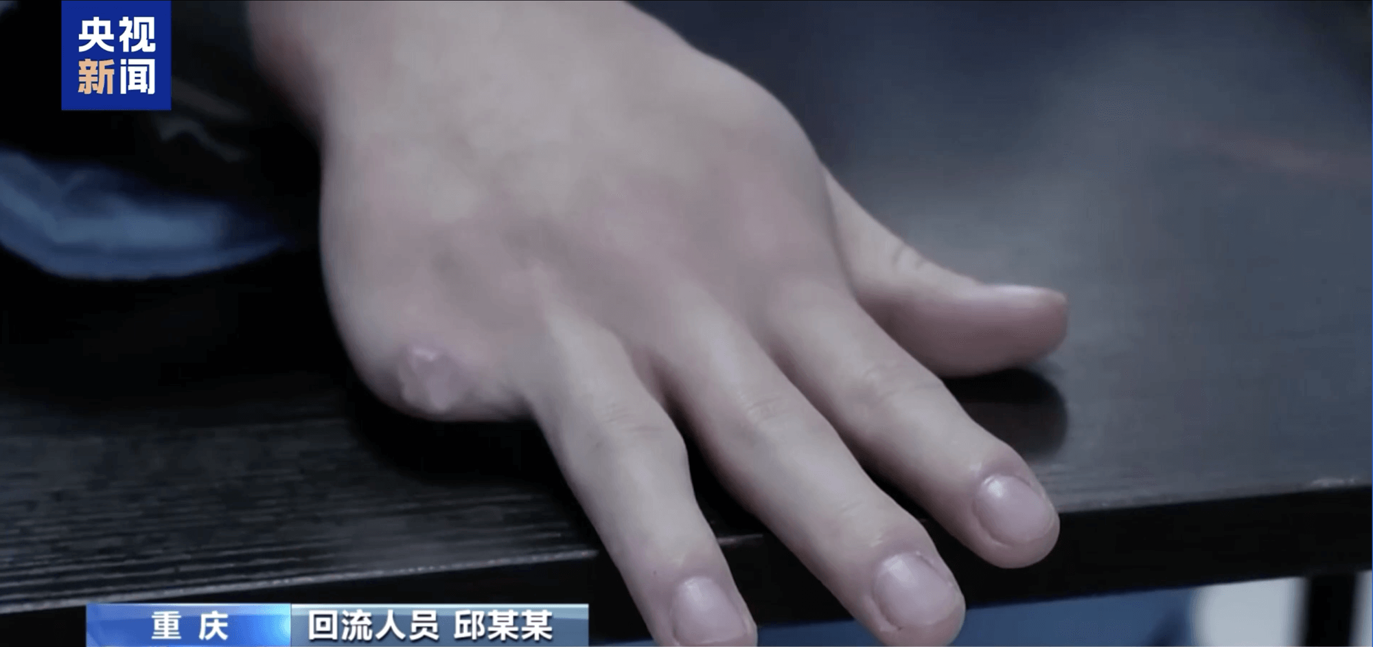 people-hand-scar-desk-CCTV News overlay