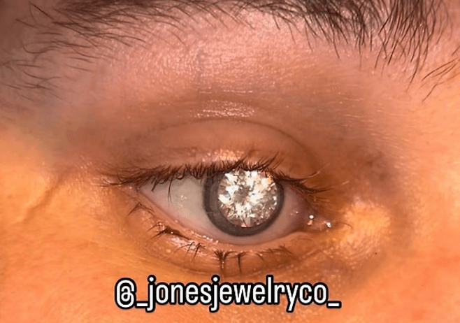 people-person-A-eye-A-diamond-A-contact lens-B-cosmetic-C