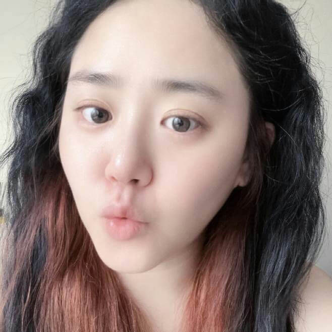 Moon Geun-young selfie rare disease recovery