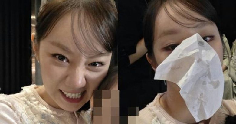 hyeri sister wedding