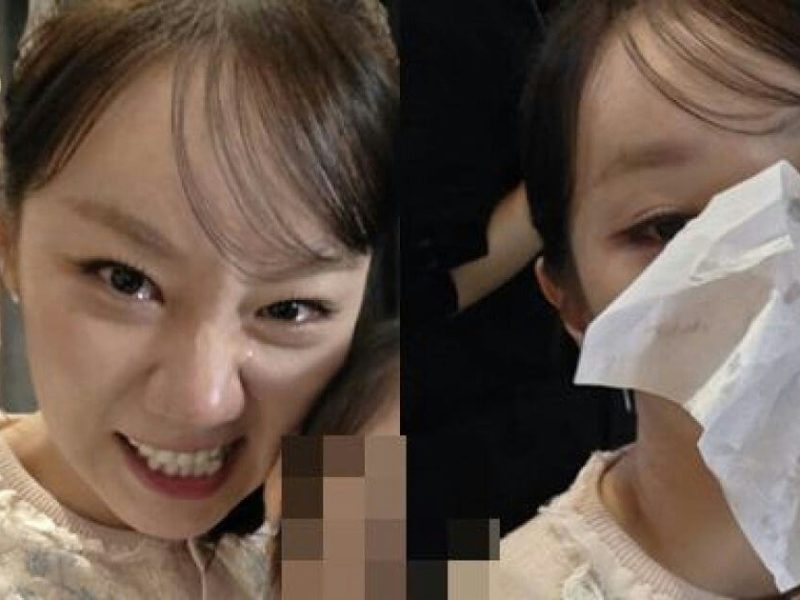 hyeri sister wedding