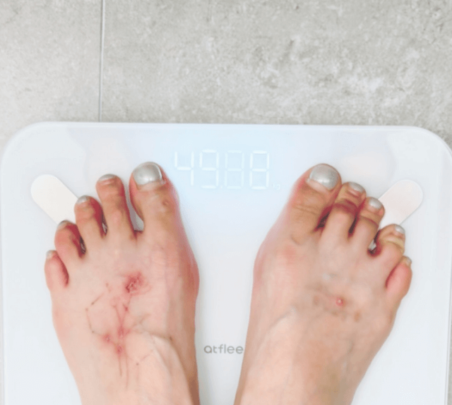 HyunA weight loss tattoo removal update
