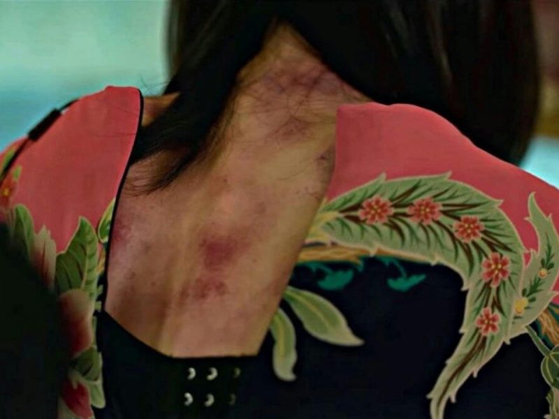 people-woman-A-bruised neck-A-pink patterned clothing-A-dark hair-B-Asian textile pattern
