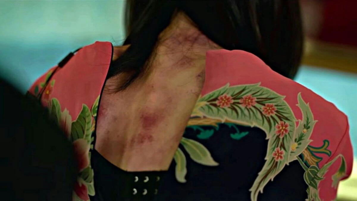people-woman-A-bruised neck-A-pink patterned clothing-A-dark hair-B-Asian textile pattern