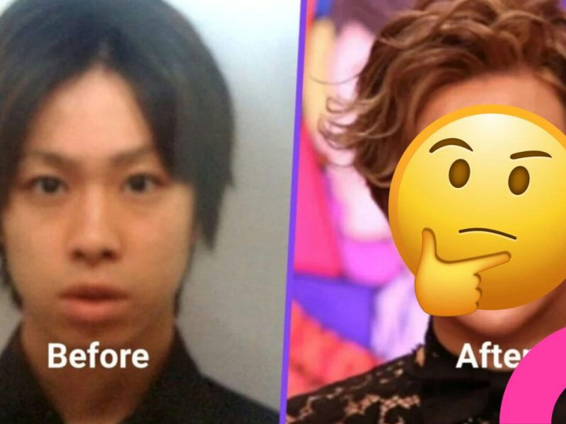 plastic surgery transformation after bullying