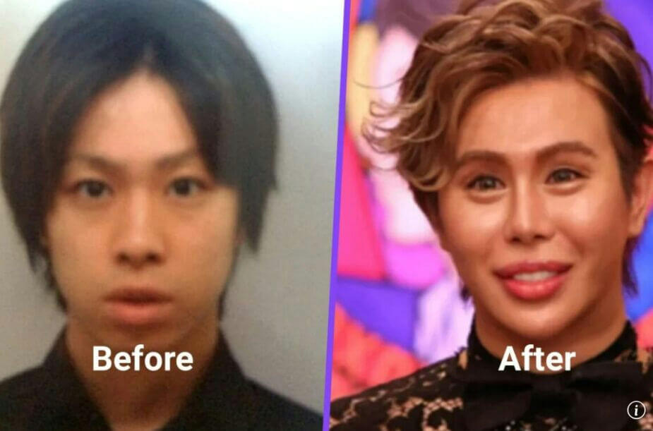 people-A-comparison-A-before-and-after-A-plastic-surgery-B-male-B-dramatic-transformation-C-Japanese-celebrity