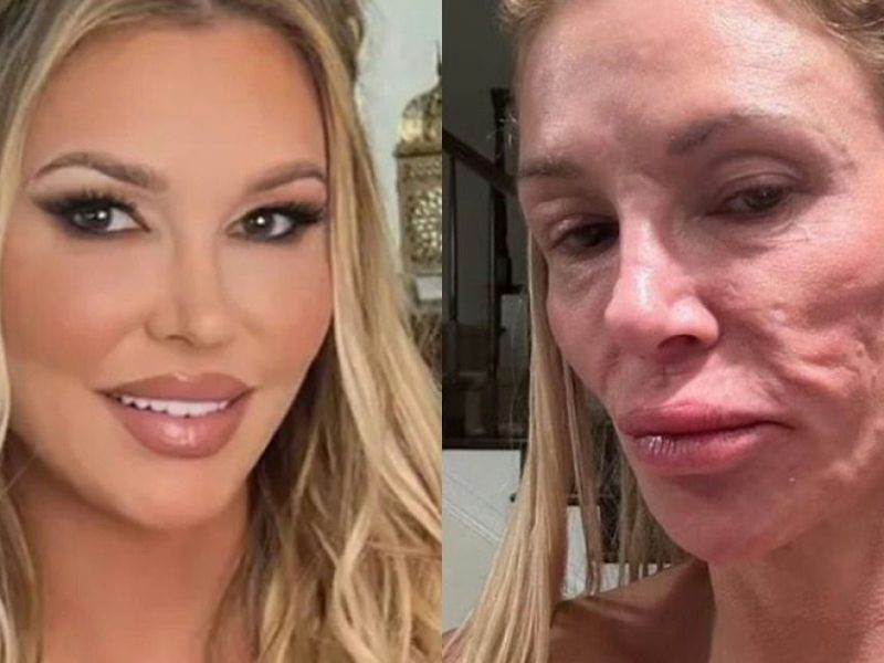 brandi glanville recovery