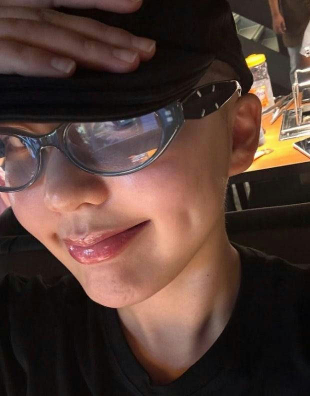 people-person-A-sunglasses-A-lipgloss-A-cap-A-dimples