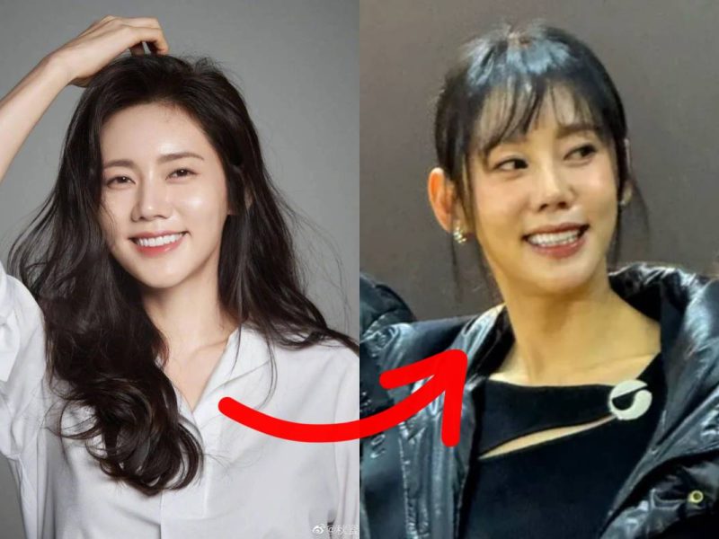 Choo Ja-hyun face change